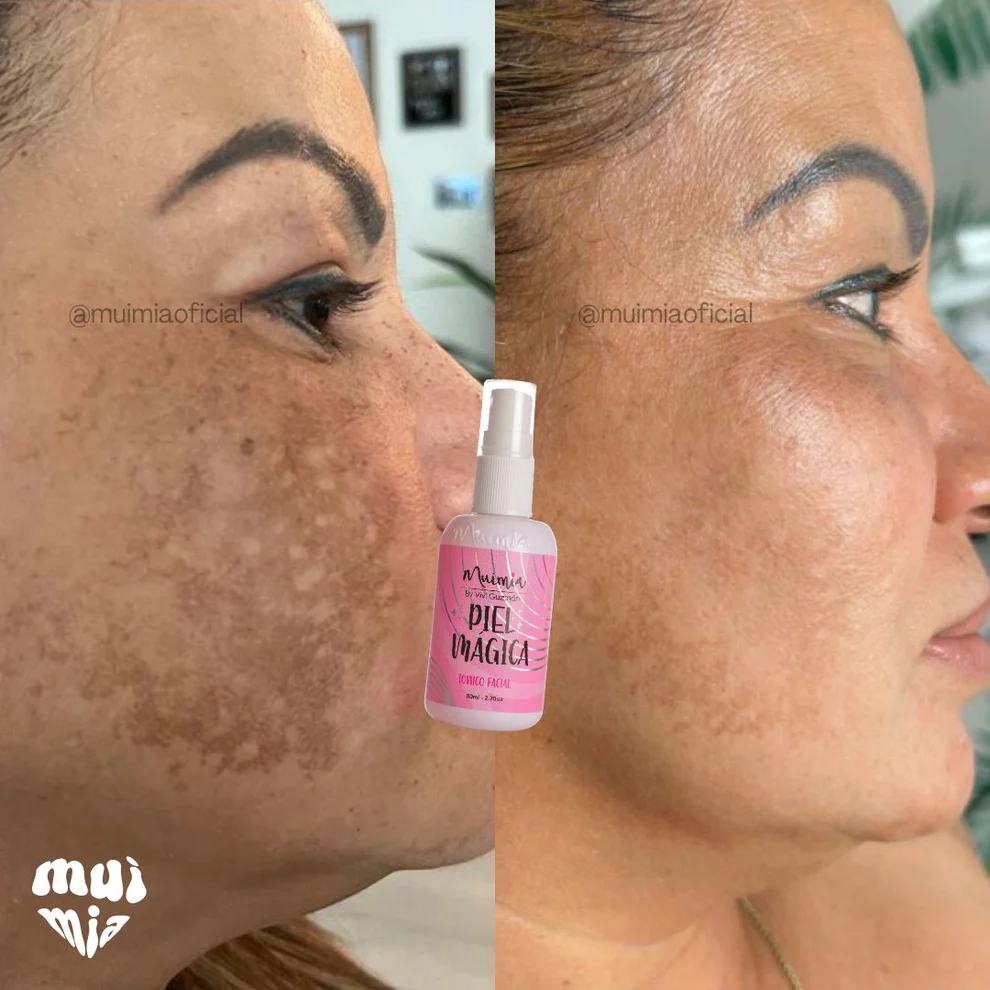 Tónico Facial Aclarante Piel Mágica Muimia - Imagen 4