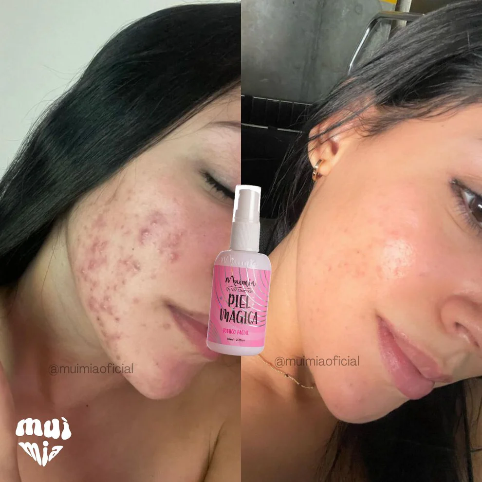Tónico Facial Aclarante Piel Mágica Muimia - Imagen 5
